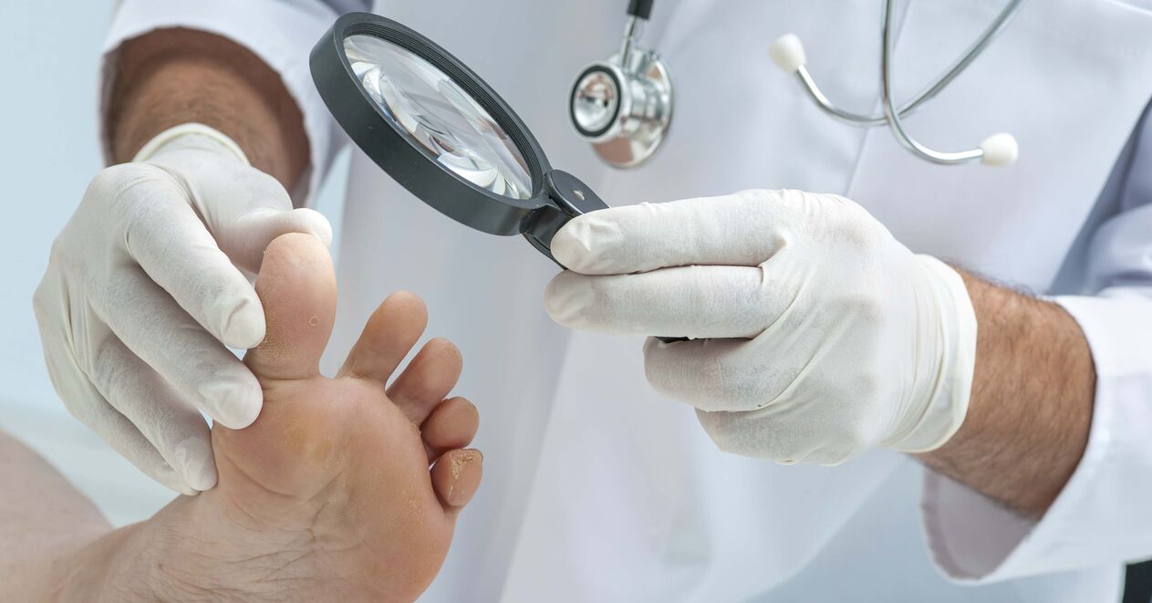 The doctor examines the feet for nail fungus.