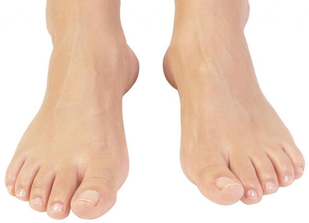 healthy toenails after fungus treatment