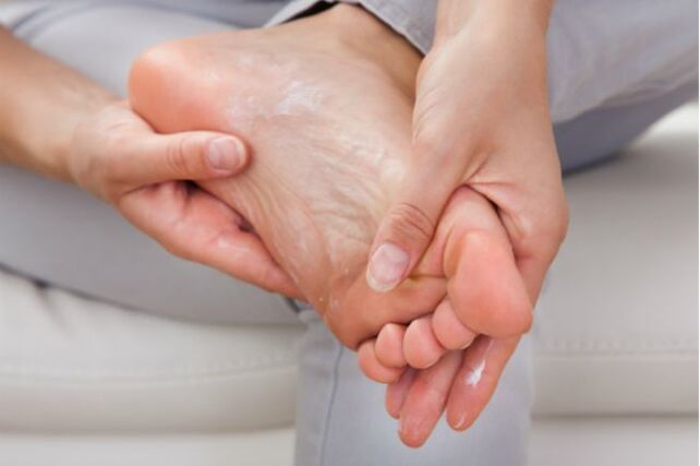 Antifungal creams and drops will help in the initial stages of toenail fungus. 
