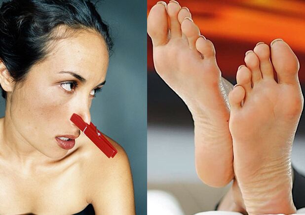 An unpleasant smell of the legs