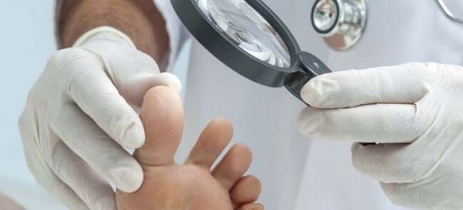 Examinations before starting fungal treatment.