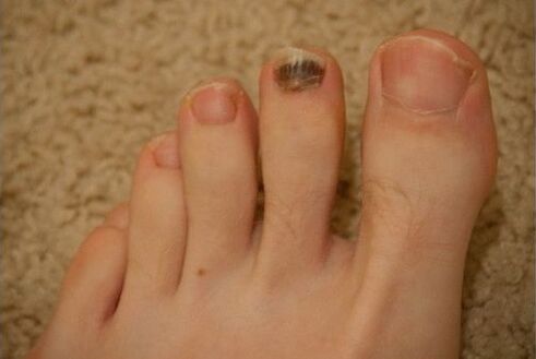 Use of oral and topical medications.