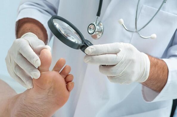 Causes and treatment of toenail fungus.