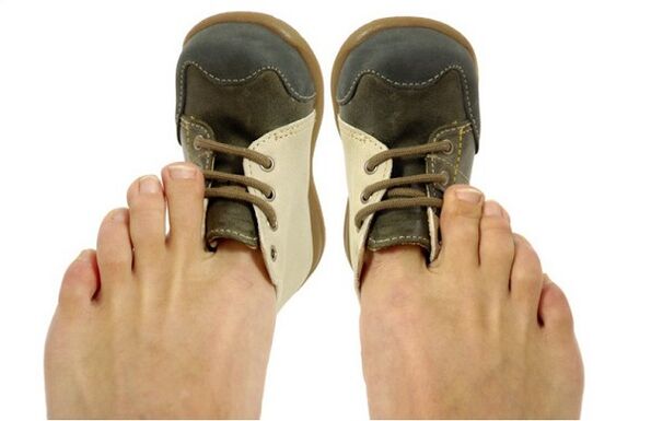 How to recognize toenail fungus by symptoms.
