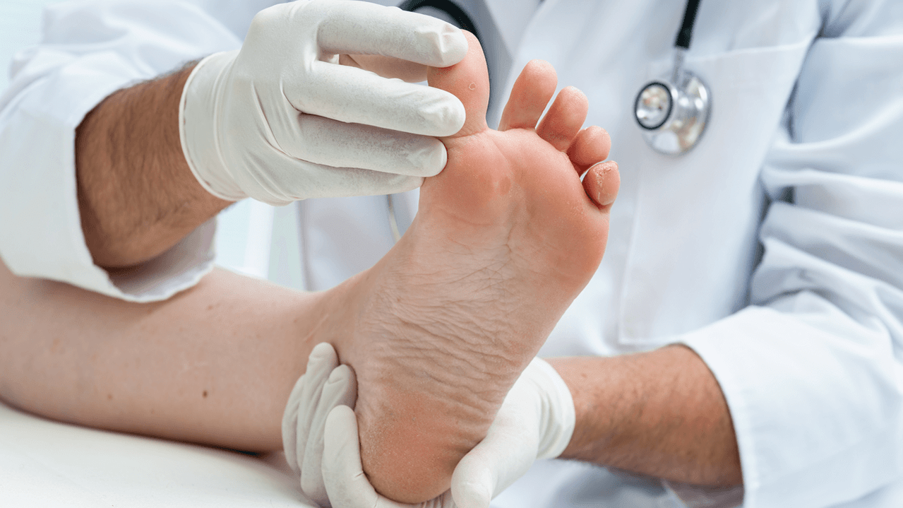 Diagnosis of foot fungus.
